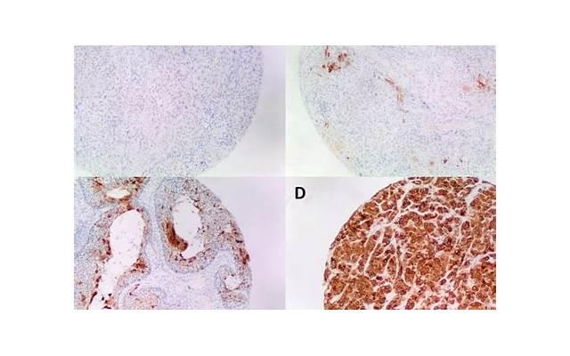 魅力值不断up 陌陌撩妹精彩的开场白
