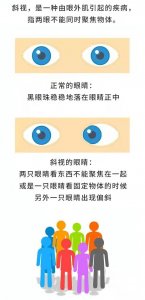 ​什么是斜视，斜视有哪些危害，如何早发现