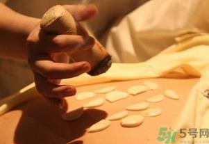 秋天适合艾灸吗？秋天可以艾灸吗？